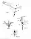 Fig. 06 - Implants and instruments for enhancing vertebral alignment and sagittal balance