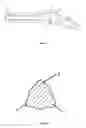Fig. 02 - Arthrodesis implant
