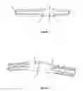 Fig. 04 - Arthrodesis implant