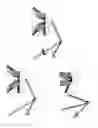 Fig. 10 - Orthopedic bone plate system