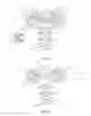 Fig. 13 - Orthopedic bone plate system