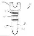 Fig. 01 - Bone fixation screw with deployable anchors