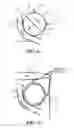 Fig. 04 - Bone fixation screw with deployable anchors