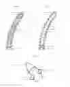 Fig. 06 - Implant for the fixation of bone elements