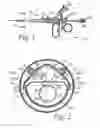 Fig. 02 - Device for resecting an organ in a cavity of a body