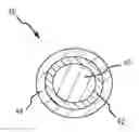 Fig. 01 - Medical device having laminate-coated braid assembly