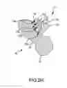Fig. 10 - Total hip replacement surgical guide tool