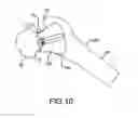 Fig. 22 - Total hip replacement surgical guide tool