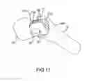 Fig. 23 - Total hip replacement surgical guide tool