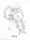 Fig. 24 - Total hip replacement surgical guide tool