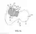 Fig. 28 - Total hip replacement surgical guide tool
