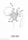 Fig. 29 - Total hip replacement surgical guide tool