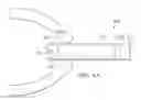 Fig. 30 - Robotic devices and systems for performing single incision procedures and natural orifice translumenal endoscopic surgical procedures, and methods of configuring robotic devices and systems