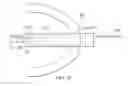 Fig. 35 - Robotic devices and systems for performing single incision procedures and natural orifice translumenal endoscopic surgical procedures, and methods of configuring robotic devices and systems