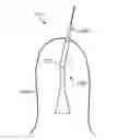 Fig. 01 - Surgical drape for transferring drive