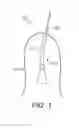Fig. 02 - Surgical drape for transferring drive