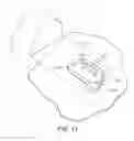 Fig. 12 - Surgical drape for transferring drive