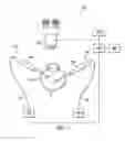 Fig. 02 - Vitreous visualization system and method