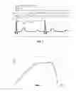 Fig. 03 - METHOD AND ARRANGEMENT FOR ELECTROMAGNETIC RADIATION BASED NON-INVASIVE MONITORING OF A PERFORMANCE OF AN ANATOMIC OBJECT DURING AN OPERATION OR MEDICAL INTERVENTION
