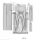 Fig. 02 - PERIODONTIC TREATMENT AND METHOD
