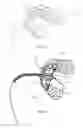 Fig. 07 - GUIDED ORTHODONTIC BRACKET APPLICATION