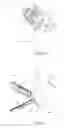 Fig. 08 - GUIDED ORTHODONTIC BRACKET APPLICATION