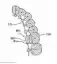 Fig. 01 - Customized orthodontic appliance and method