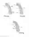 Fig. 04 - Customized orthodontic appliance and method