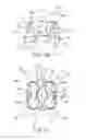 Fig. 08 - Customized orthodontic appliance and method