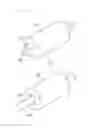 Fig. 04 - ORTHODONTIC DEVICE