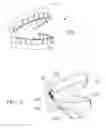 Fig. 02 - Orthodontic Vector Force Application Apparatus