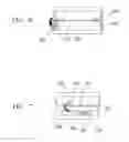 Fig. 04 - Method and apparatus for applying curved vector forces for orthodontic corrections