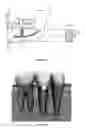 Fig. 02 - Dental implant