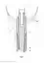 Fig. 02 - Dental prosthesis with threaded crown on post and core