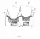 Fig. 07 - Dental prosthesis with threaded crown on post and core