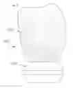 Fig. 06 - Dental prosthetic