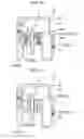Fig. 14 - Oral cavity washing device