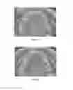 Fig. 22 - Intra-oral light-therapy apparatuses and methods for their use