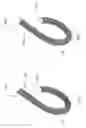 Fig. 08 - Stent and method of use