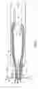 Fig. 06 - Implantable fastening device for securing a graft to at least one bone of a joint