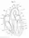 Fig. 02 - DEVICE FOR INSERTION INTO HUMAN OR ANIMAL BODY AND ASSOCIATED METHODS