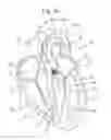 Fig. 03 - DEVICE FOR INSERTION INTO HUMAN OR ANIMAL BODY AND ASSOCIATED METHODS