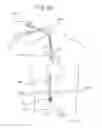Fig. 04 - DEVICE FOR INSERTION INTO HUMAN OR ANIMAL BODY AND ASSOCIATED METHODS