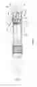 Fig. 04 - METHODS AND SYSTEMS FOR RAPID RETRACTION OF A TRANSCATHETER HEART VALVE DELIVERY SYSTEM