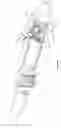 Fig. 09 - METHODS AND SYSTEMS FOR RAPID RETRACTION OF A TRANSCATHETER HEART VALVE DELIVERY SYSTEM
