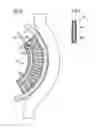 Fig. 06 - Infusion of drugs