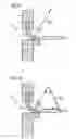 Fig. 08 - Infusion of drugs