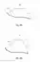 Fig. 09 - Method of implanting a penile prosthetic in treating erectile dysfunction