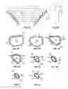 Fig. 04 - Anatomically shaped augments