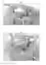 Fig. 02 - Meniscus for joint reconstruction
